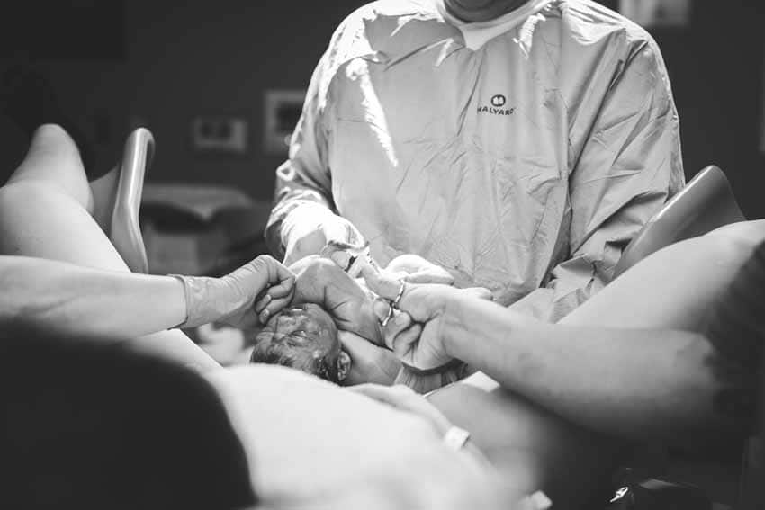 Cutting new baby's umbilical cord black and white